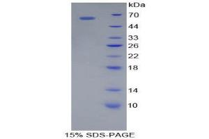 Image no. 1 for Cathepsin A (CTSA) (AA 215-470) protein (His tag,GST tag) (ABIN1879452)
