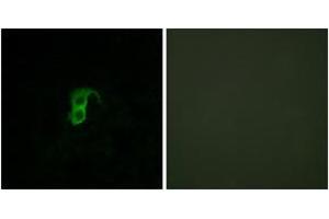 Image no. 2 for anti-G Protein-Coupled Receptor 87 (GPR87) (AA 221-270) antibody (ABIN1535752)