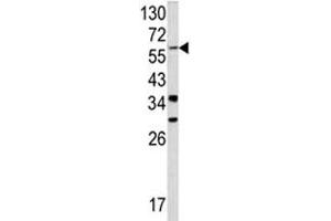Image no. 3 for anti-Yes-Associated Protein 1 (YAP1) (AA 420-446) antibody (ABIN3029661)