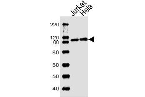 Image no. 1 for anti-Ubiquitin Specific Peptidase 11 (USP11) antibody (ABIN4915064)