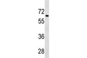 Image no. 1 for anti-Transforming Growth Factor, beta Receptor II (70/80kDa) (TGFBR2) (AA 548-575) antibody (ABIN3029225)
