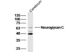 Image no. 2 for anti-Chondroitin Sulfate Proteoglycan 5 (Neuroglycan C) (CSPG5) (AA 351-450) antibody (ABIN1385741)