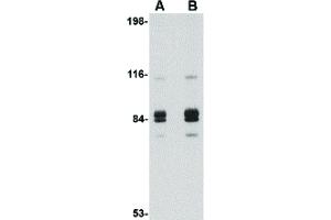 Image no. 1 for anti-Syntaphilin (SNPH) (Internal Region) antibody (ABIN6656394)