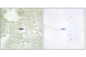 Image no. 3 for anti-Transforming Growth Factor, beta Receptor II (70/80kDa) (TGFBR2) (pSer225), (pSer250) antibody (ABIN1847404)