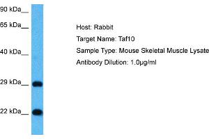 anti-TAF10 RNA Polymerase II, TATA Box Binding Protein (TBP)-Associated Factor, 30kDa (TAF10) (Middle Region) antibody