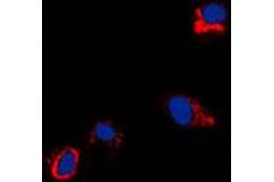 Image no. 1 for anti-Coxsackie Virus and Adenovirus Receptor (CXADR) (N-Term) antibody (ABIN2707461)