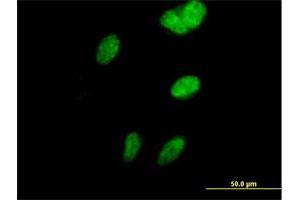 Immunofluorescence of purified MaxPab antibody to SORBS3 on HeLa cell.