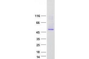 Image no. 1 for STEAP Family Member 4 (STEAP4) protein (Myc-DYKDDDDK Tag) (ABIN2732842)