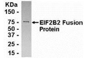 Image no. 1 for anti-Eukaryotic Translation Initiation Factor 2B, Subunit 2 Beta, 39kDa (EIF2B2) (AA 1-210) antibody (ABIN2468092)