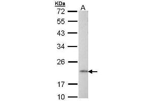 AP1S2 Antikörper  (full length)
