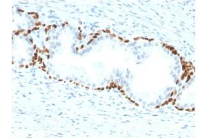 Image no. 4 for anti-Tumor Protein P63 (TP63) antibody (ABIN6940967)