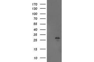 Image no. 2 for anti-Adenylate Kinase 4 (AK4) antibody (ABIN1496524)