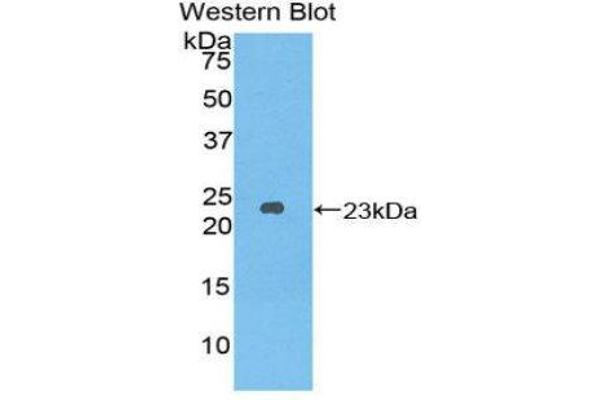 anti-Dishevelled, Dsh Homolog 2 (Drosophila) (DVL2) (AA 78-250) antibody