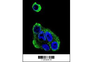 Image no. 4 for anti-Alcohol Dehydrogenase 1B (Class I), beta Polypeptide (ADH1B) (Center) antibody (ABIN2157593)