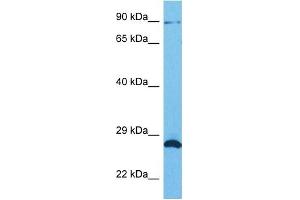 Image no. 3 for anti-Sad1 and UNC84 Domain Containing 1 (SUN1) (N-Term) antibody (ABIN2783971)