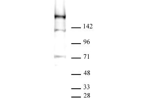 Image no. 3 for anti-Lysine (K)-Specific Demethylase 5A (KDM5A) antibody (ABIN6972256)