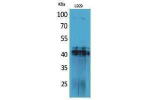 Western Blotting (WB) image for anti-Platelet Derived Growth Factor D (PDGFD) (C-Term) antibody (ABIN3187818)