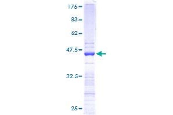RPS19 Protein (Ribosomal Protein S19) (AA 1-145) (GST tag)