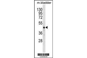 Image no. 2 for anti-RNA Binding Motif Protein 41 (RBM41) (AA 316-343), (C-Term) antibody (ABIN1537118)