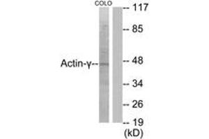 Image no. 1 for anti-Actin, gamma 2, Smooth Muscle, Enteric (ACTG2) (AA 1-50) antibody (ABIN1533207)