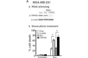 Image no. 5 for anti-Actin, beta (ACTB) (AA 359-368) antibody (ABIN129657)