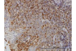 Image no. 1 for anti-N-Myc (And STAT) Interactor (NMI) (AA 1-100) antibody (ABIN563941)