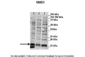 Image no. 2 for anti-Non-Metastatic Cells 1, Protein (NM23A) Expressed in (NME1) (N-Term) antibody (ABIN2792090)