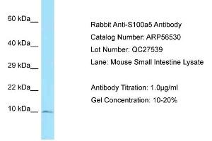 Image no. 1 for anti-S100 Calcium Binding Protein A5 (S100A5) (Middle Region) antibody (ABIN2786757)