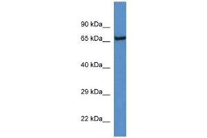 Image no. 1 for anti-Kallikrein B, Plasma (Fletcher Factor) 1 (KLKB1) (C-Term) antibody (ABIN2782313)
