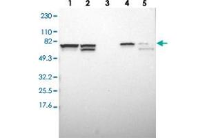 Image no. 3 for anti-SET Domain Containing 3 (SETD3) antibody (ABIN5587780)