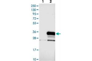 Image no. 2 for anti-NEDD4 Binding Protein 2-Like 1 (N4BP2L1) antibody (ABIN5584156)