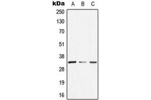 Image no. 1 for anti-General Transcription Factor IIE, Polypeptide 2 (GTF2E2) (Center) antibody (ABIN2706288)