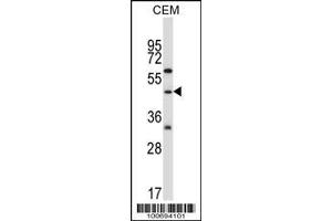 Image no. 1 for anti-Cbl proto-oncogene C (CBLC) (AA 1-30), (N-Term) antibody (ABIN388071)