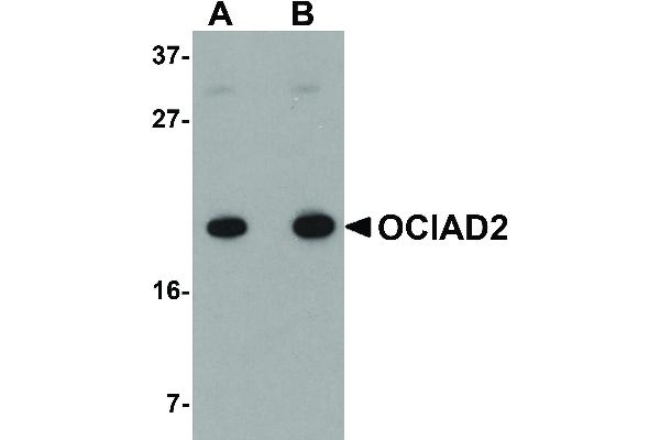 OCIAD2 anticorps  (C-Term)