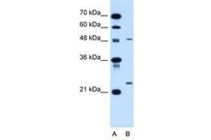 Image no. 1 for anti-Sphingomyelin phosphodiesterase 2, Neutral Membrane (Neutral Sphingomyelinase) (SMPD2) (AA 60-109) antibody (ABIN205079)