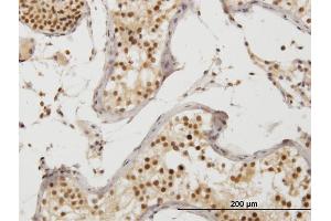 anti-Mitogen-Activated Protein Kinase Kinase Kinase MLT (ZAK) (AA 1-120) antibody