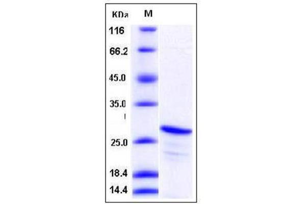 Calcium And Integrin Binding Family Member 2 (CIB2) (AA 1-187), (Mature) protein (His tag)