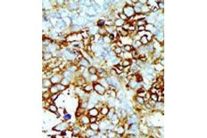 Image no. 1 for anti-Mitogen-Activated Protein Kinase Kinase Kinase Kinase 2 (MAP4K2) (Middle Region) antibody (ABIN359142)