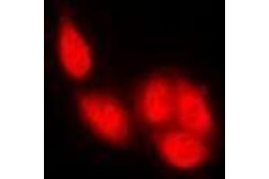 Image no. 2 for anti-Nuclear Factor of Activated T-Cells, Cytoplasmic, Calcineurin-Dependent 1 (NFATC1) (full length) antibody (ABIN6005842)