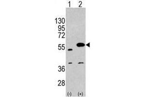 Image no. 1 for anti-Sprouty-Related, EVH1 Domain Containing 1 (SPRED1) (C-Term) antibody (ABIN356945)