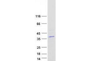 Image no. 1 for Lymphocyte Antigen 6 Complex, Locus G6F (LY6G6F) protein (Myc-DYKDDDDK Tag) (ABIN2725034)