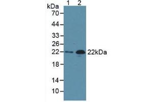 Image no. 1 for anti-Pro-Brain Natriuretic Peptide (NT-ProBNP) (NT-ProBNP) antibody (ABIN5662132)