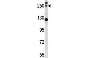 Image no. 2 for anti-Complement Component C4b (C4b) (AA 655-684) antibody (ABIN3030240)