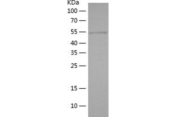 c-Rel Protein (AA 15-218) (IF2DI tag)