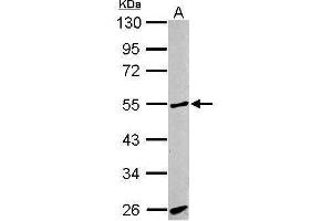 Image no. 1 for anti-Activin A Receptor Type II-Like 1 (ACVRL1) (C-Term) antibody (ABIN2857028)