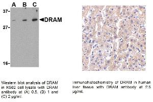 Image no. 1 for anti-DNA-Damage Regulated Autophagy Modulator 1 (DRAM1) (N-Term) antibody (ABIN1304279)