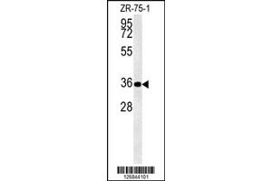 Western Blotting (WB) image for anti-D4, Zinc and Double PHD Fingers, Family 3 (DPF3) antibody (ABIN2158592)