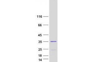Image no. 1 for Spindlin 2B (SPIN2B) (Transcript Variant 3) protein (Myc-DYKDDDDK Tag) (ABIN2732587)