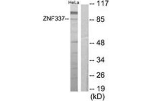Western blot analysis of extracts from HeLa cells, using ZNF337 Antibody.