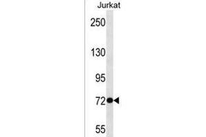 ANKRD56 Antibody (Center) (ABIN1538405 and ABIN2850334) western blot analysis in Jurkat cell line lysates (35 μg/lane).